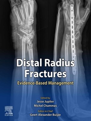 cover image of Distal Radius Fractures